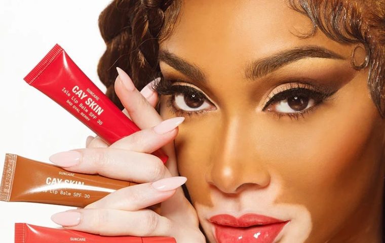Why Winnie Harlow’s Tribute to Whitney Houston Sparked Heated Debates