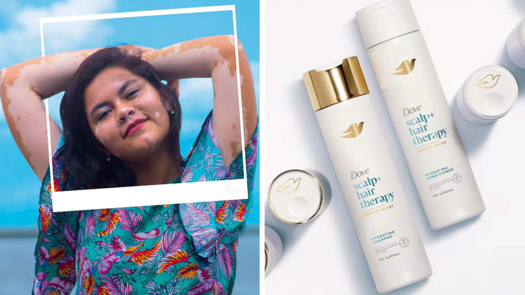 Woman with vitiligo beside Dove hair-care products.